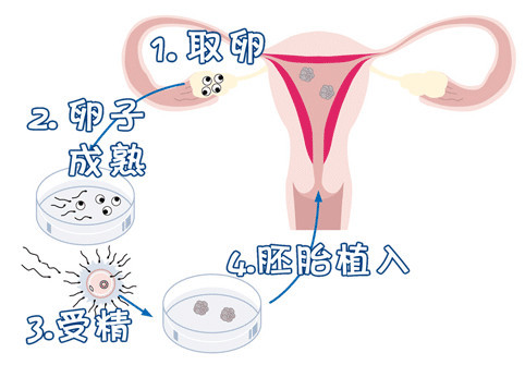 生殖内分泌专家