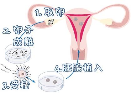 高龄二胎成功案例